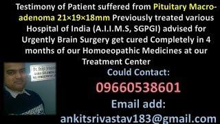 Pituitary Macroadenoma, Brain Tumor Treatment (ब्रेन ट्यूमर का उपचार)