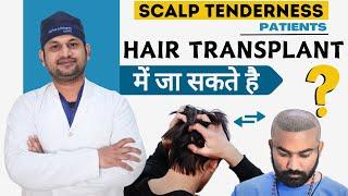 Hair Transplant With Scalp Tenderness? | Cost of Hair Transplant & Hair Transplant Doctor in Bhopal