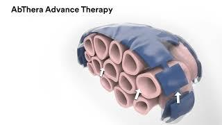 3M™ AbThera™ Advance Mechanism of Action Video