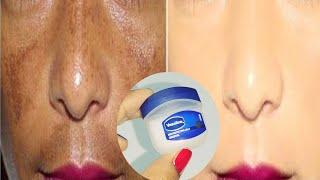 Vaseline for skin whitening | How to use vaseline on face | Vaseline for dry skin face