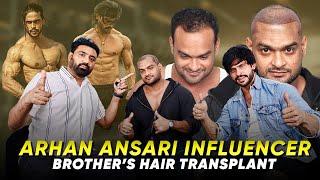 Social Media Influncer Arhan Ansari’s Brother Hair Transplant | Bodybuilder Hair Transplant in India