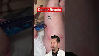 ER Doctor REACTS to "Most Satisfying" Hair Splinter Removal