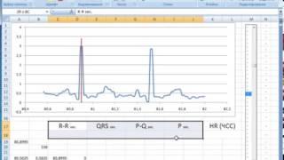 Manipulation ECG in MS Excel (Обработка ЭКГ в MS Excel)