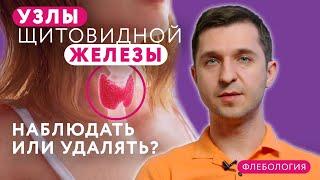 Как лечить узлы щитовидной железы? // #клиникащербатовой #щитовидка #щитовиднаяжелеза