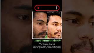 Collagen Products in Herbalife Skin Booster || Wellness Coach - 6369484966 / 9080720753