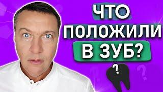 Какое ЛЕКАРСТВО кладут под временную пломбу? Лечение пульпита и периодонтита под временной пломбой.