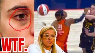 Caitlin Clark BLACK EYE BACKLASH! Christie Sides REFUSES to CALL OUT WNBA Referees for HEINOUS ACT!