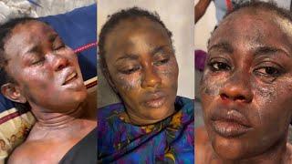 See What Happen To Nollywood Actress Juliet Jatto On Set | Filming Location