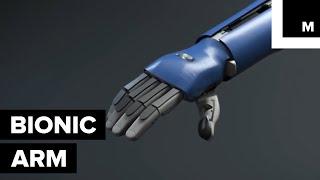 Open Bionics Just Released an Affordable and Intuitive Bionic Arm That Can Even Fit Kids