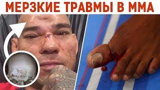 САМЫЕ жестокие травмы в ММА/UFC #2 Джон Джонс, Чейл Соннен, Ногейра