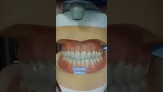 How to make A Complete Denture|Complete Denture|CD model|Prosthodontic Dentistry Shorts