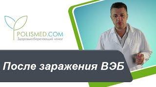 После заражения вирусом Эпштейна-Барр: действие на ЦНС, синдром хронической усталости