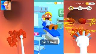 Earwax Clinic All Levels Gameplay Android, iOS