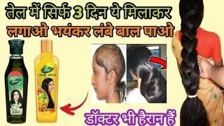 Dabur Amla oil,आंवला तेल बस 3 दिन ये चीज मिलाके लगालो बाल इतने बढ़ेंगे संभाल नहीं पाओगे,Dabur Sarson