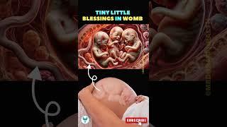 Triple the joy | Tiny little miracles growing together #baby #blessings #pregnancy