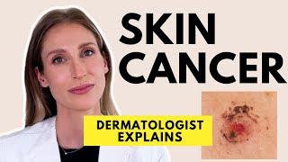 Skin Cancer: Different Types, Causes, Prevention & Treatments | Dr. Sam Ellis