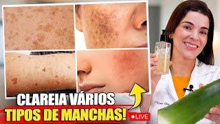 LIVRE-SE DAS MANCHAS DE PELE, Como Clarear com TODAS as Manchas de Pele RAPIDAMENTE!