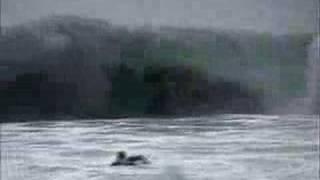 No Friends Bodyboard - Retina Rehab
