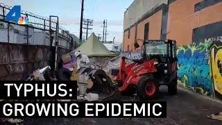 Typhus Epidemic Worsens in Los Angeles | NBCLA