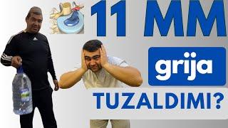 11MM GRIJA TUZALDIMI?+998903922158