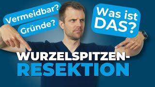 Wurzelspitzenresektion - Was ist das und lässt es sich vermeiden?