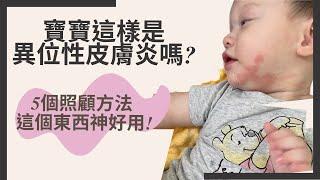 寶寶異位性皮膚炎好難過! 怎麼照顧惱人異膚寶寶? 急救補水這樣做! 這個東西必備，天然便宜又有效改善膚況!