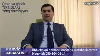 T.e.d. Parviz Abbasov..Qasıq və göbək yırtıqları. Yırtıq cərrahiyyəsi.