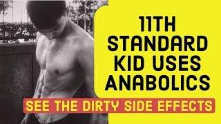 11th Standard boy uses anabolics | Paid the price