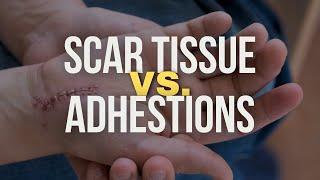 Scar Tissue vs. Adhesions: What’s the Difference?