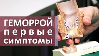 Признаки геморроя.  Первые признаки геморроя и трещины заднего прохода. МОСИТАЛМЕД