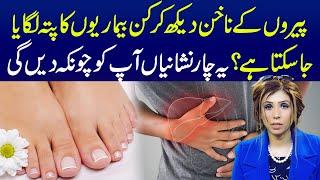 Diseases Your Toenails Can Reveal About Your Health | Dr Sahar Chawla