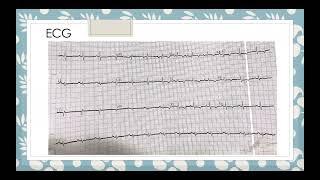Case of antiphospholipid antibody syndrome
