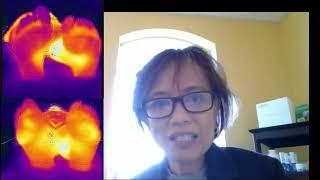 How This Patient Stopped Suffering From Neuropathy in 3 weeks!