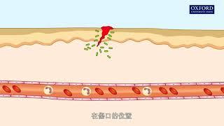 動畫24.1 炎性反應