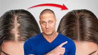 9 Easy Tips on How to Stop Hair Loss and Regrow Hair Naturally