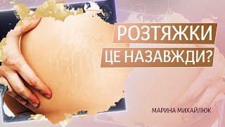 Розтяжки це назавжди?