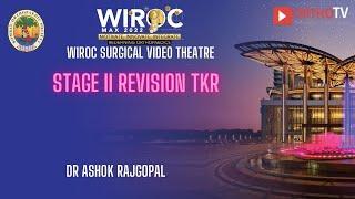 Stage II Revision TKR Dr Ashok Rajgopal