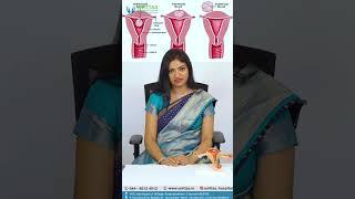 Diving into Uterine Fibroids with Dr. Binu! |  Unittas Multispeciality Hospital, Chennai