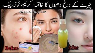 Dark spots Treatment,by Merium ka jahaan/How to Reduce dark spots on face, #darkspots