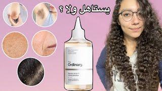 The ordinary glycolic acid |الجليكوليك اسيد من اورديناري و حقيقة علاجه لمشاكل البشرة و الشعر و الجسم