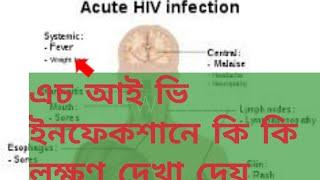 wat r the early symptoms of HIV infection|acute hiv syndrome|bengali