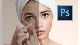 photoshop tutorial for beginners | photoshop effects |skin finner | skin retouching| pimple removing