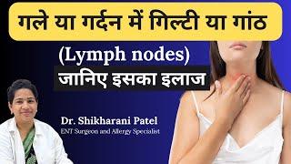 गले या गर्दन में गिल्टी या गांठ कैसे बनती है I जानिए इसका इलाज | Swollen lymph nodes | Dr Shikharani