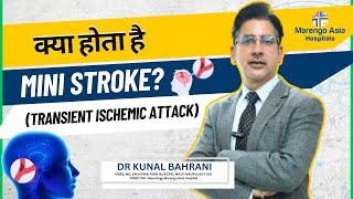 क्या होता है Mini Stroke? (Transient Ischemic Attack) | Symptoms of Mini Stroke | Dr. Kunal Bahrani