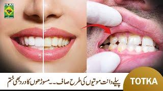 Homemade Teeth Whitening Powder | Hakim Shah Nazir | Kiran Khan | Masala TV