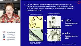 Экспертология | «Сладж» в околоплодных водах как маркер ВУИ Пустотина О.А.