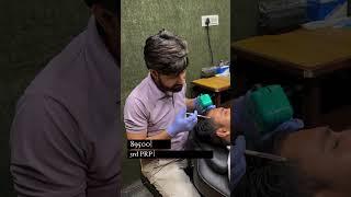 3rd PRP After Hair Transplant |PRP for Therapy Best Hair Growth |Hair transformation #shorts #viral