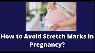 How to prevent stretch marks during pregnancy?