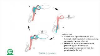 Anatomy of lacrimal drainage pathway, PANDO and SALDO