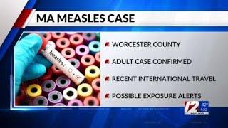 First case of measles in Massachusetts since 2020